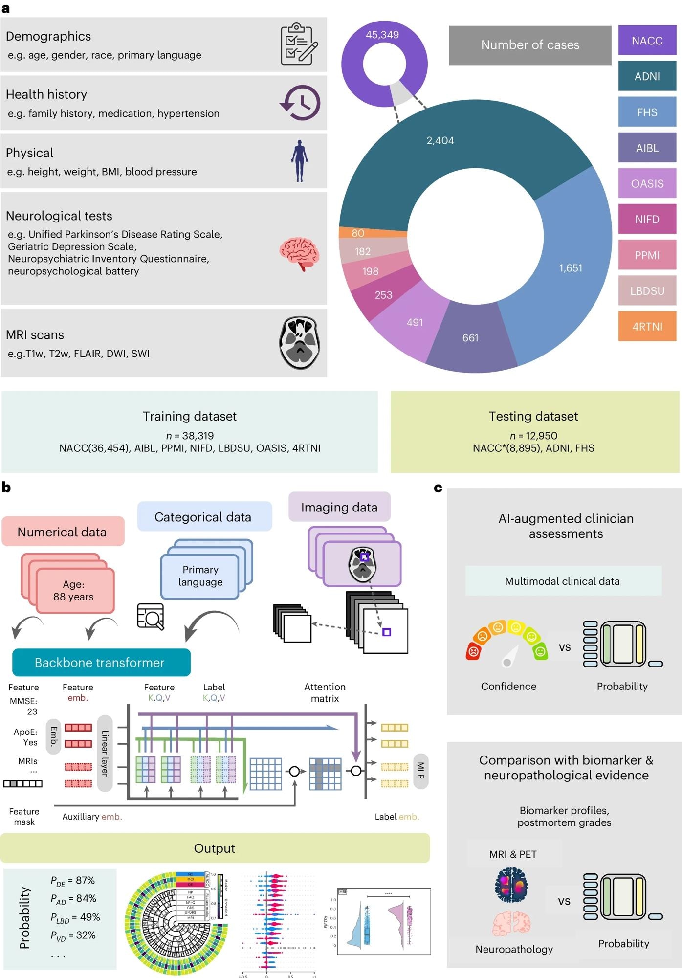 a, Our model for differential dementia diagnosis was developed using diverse data modalities, including individual-level demographics, health history, neurological testing, physical/neurological exams and multisequence MRI scans. These data sources whenever available were aggregated from nine independent cohorts: 4RTNI, ADNI, AIBL, FHS, LBDSU, NACC, NIFD, OASIS and PPMI (Tables 1 and S1). For model training, we merged data from NACC, AIBL, PPMI, NIFD, LBDSU, OASIS and 4RTNI. We used a subset of the NACC dataset for internal testing. For external validation, we utilized the ADNI and FHS cohorts. b, A transformer served as the scaffold for the model. Each feature was processed into a fixed-length vector using a modality-specific embedding (emb.) strategy and fed into the transformer as input. A linear layer was used to connect the transformer with the output prediction layer. c, A subset of the NACC testing dataset was randomly chosen to conduct a comparative analysis between neurologists