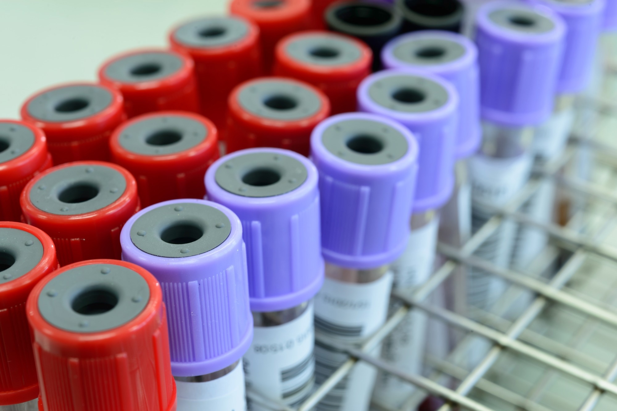 Study: Disease prediction with multi-omics and biomarkers empowers case–control genetic discoveries in the UK Biobank. Image Credit: Xray Computer/Shutterstock.com