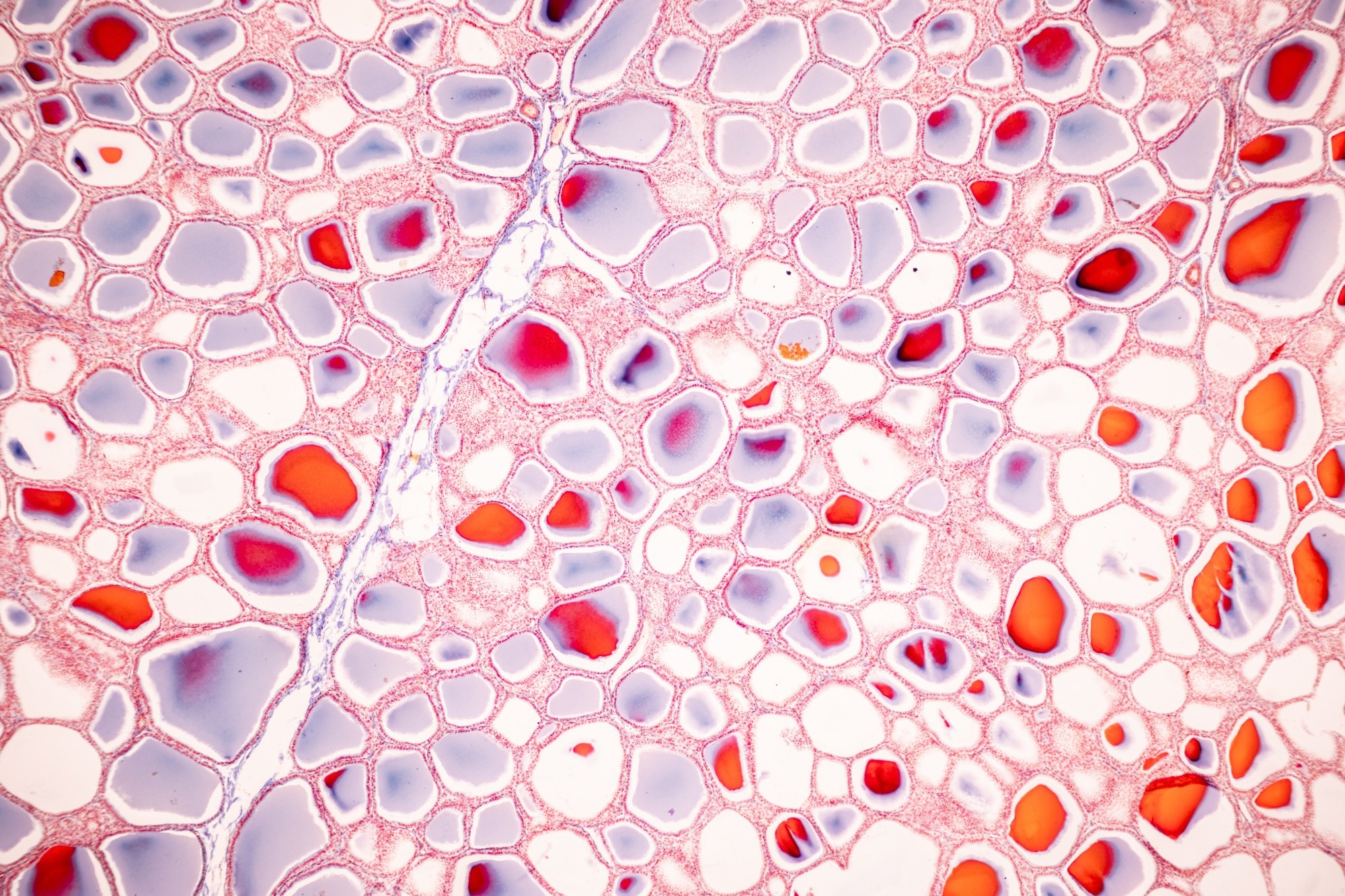 Cells in the thyroid gland