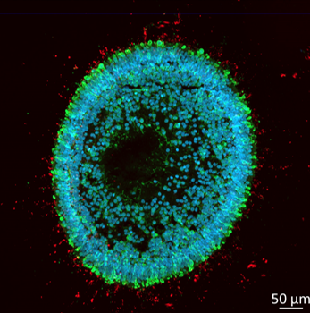 image of a retinal organoid