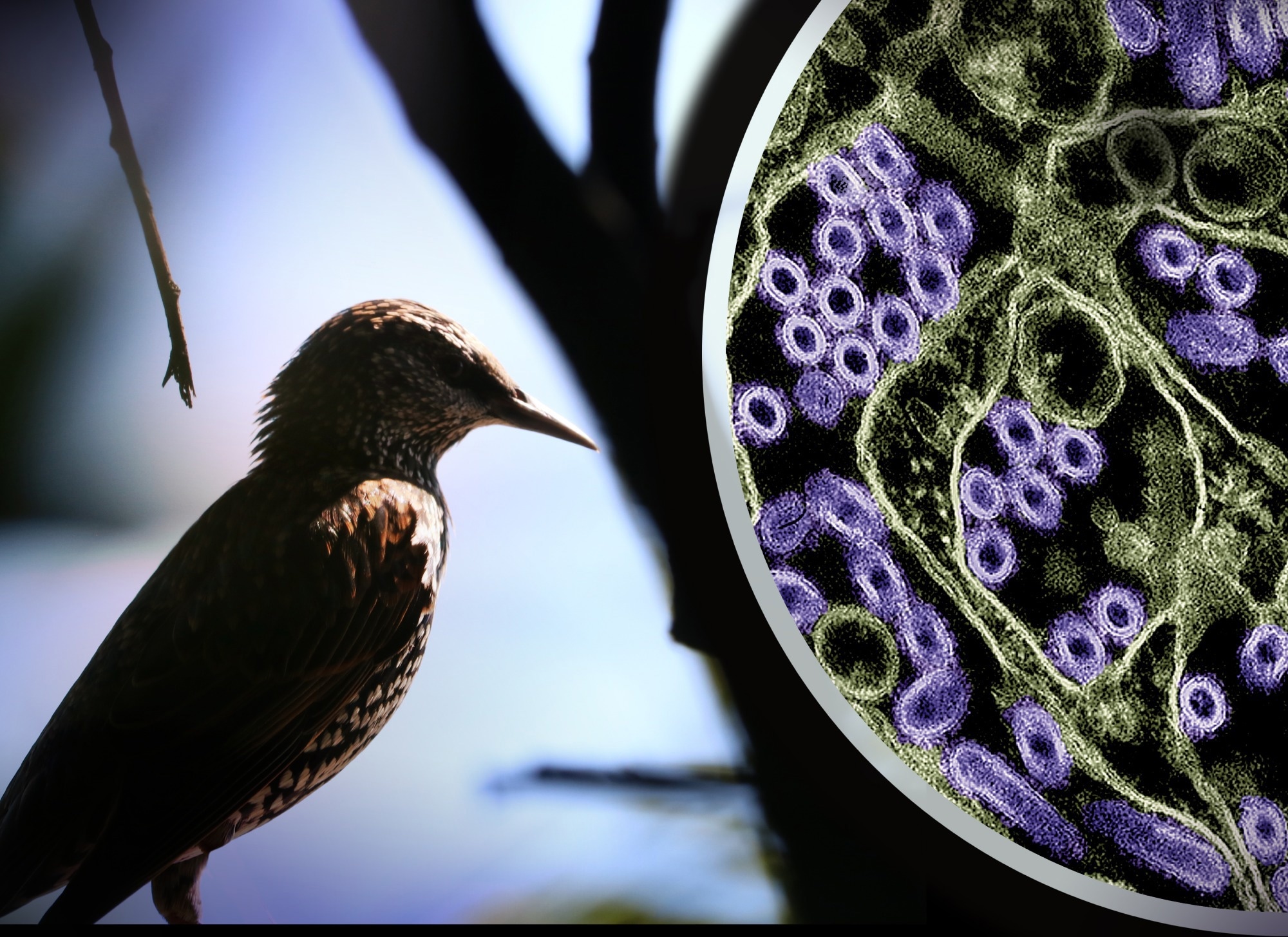 Dispatch: Comparison of Contemporary and Historic Highly Pathogenic Avian Influenza A(H5N1) Virus Replication in Human Lung Organoids. Image Credit: Credit: NIAID and CDC