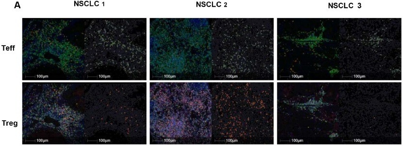 Detecting tissue-resident memory T cells in solid tumors