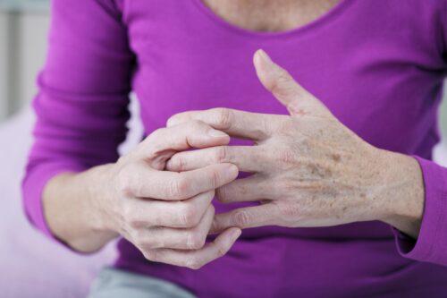 arthritis home remedies