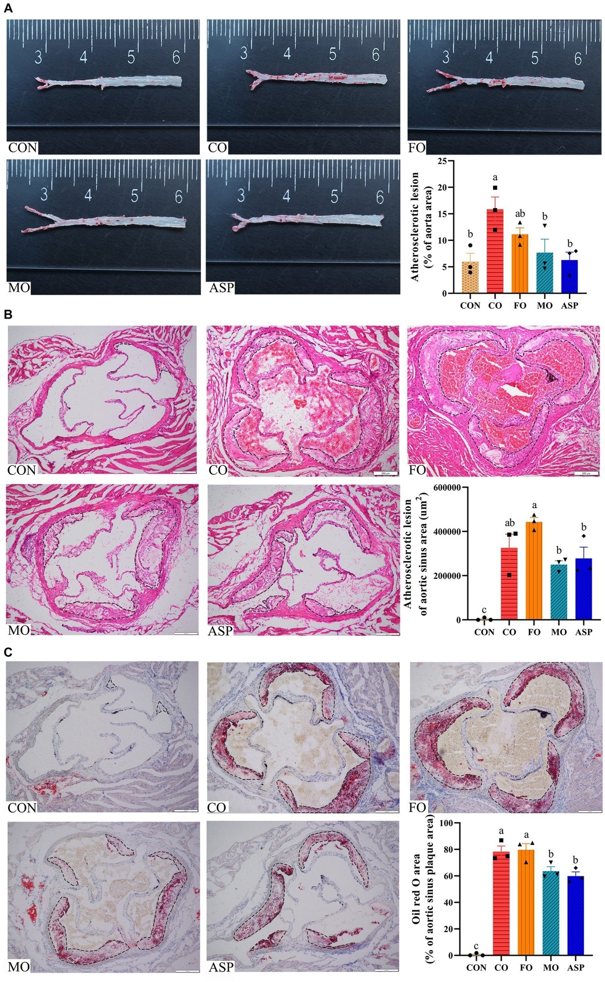 Effect of treatment oils on atherosclerotic plaque in the aorta (A) and aortic sinus (B,C). Three mice in each group were included for analysis. For B–C, 2 serial sections of each mice were used, and the mean of two sections from one mice was included in the final analysis. Atherosclerotic plaque in the aorta was detected by Oil-red O staining (A). Atherosclerotic plaque and lipid deposition in the aortic sinus was detected by H&E (B) and Oil-red O staining (C), respectively. The outline of the atherosclerotic lesions in the aortic sinus was marked with a black dashed line. The result of Oil red O staining in the aortic sinus was normalized by atherosclerotic plaque area. Data were expressed as mean ± SEM. There was significance if groups did not share the same letter (p < 0.05). CON, health control; CO, corn oil; FO, fish oil; MO, mussel oil; ASP, aspirin.