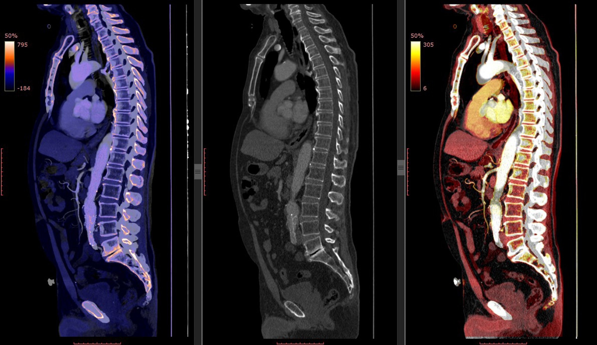 Review Article: A guide to artificial intelligence for cancer researchers