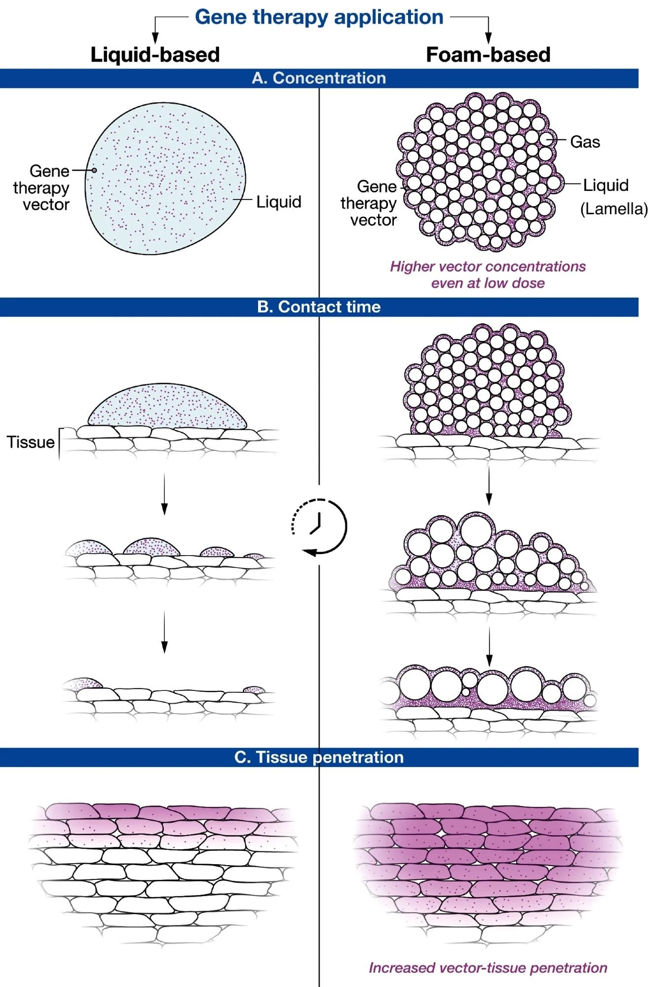 Schematic explaining the key advantages of foam as a gene delivery system in comparison to conventional liquid formulations. A Foam is mostly gas, so the embedded vector particles become heavily concentrated in its liquid component, which ensures high-density exposure of target tissue to the gene therapy vector. B Foam remains at the application site longer, thereby enhancing the delivery of the gene therapy drug to the intended cells and minimizing unwanted off-target effects. C Higher vector density combined with longer contact time results in higher transfection rates and deeper tissue penetration.