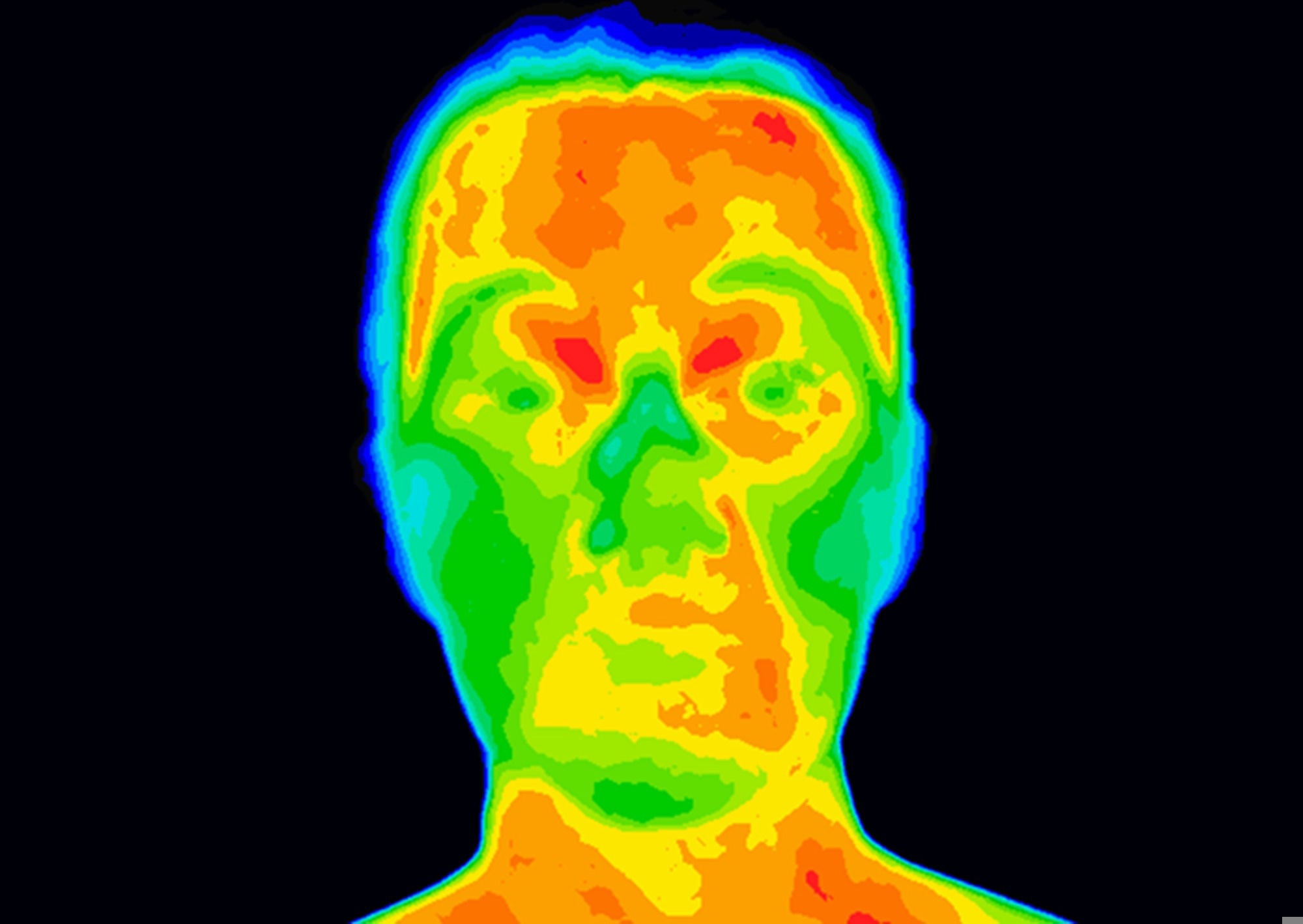 Study: Prediction of coronary artery disease based on facial temperature information captured by non-contact infrared thermography. Image Credit: Anita van den Broek / Shutterstock