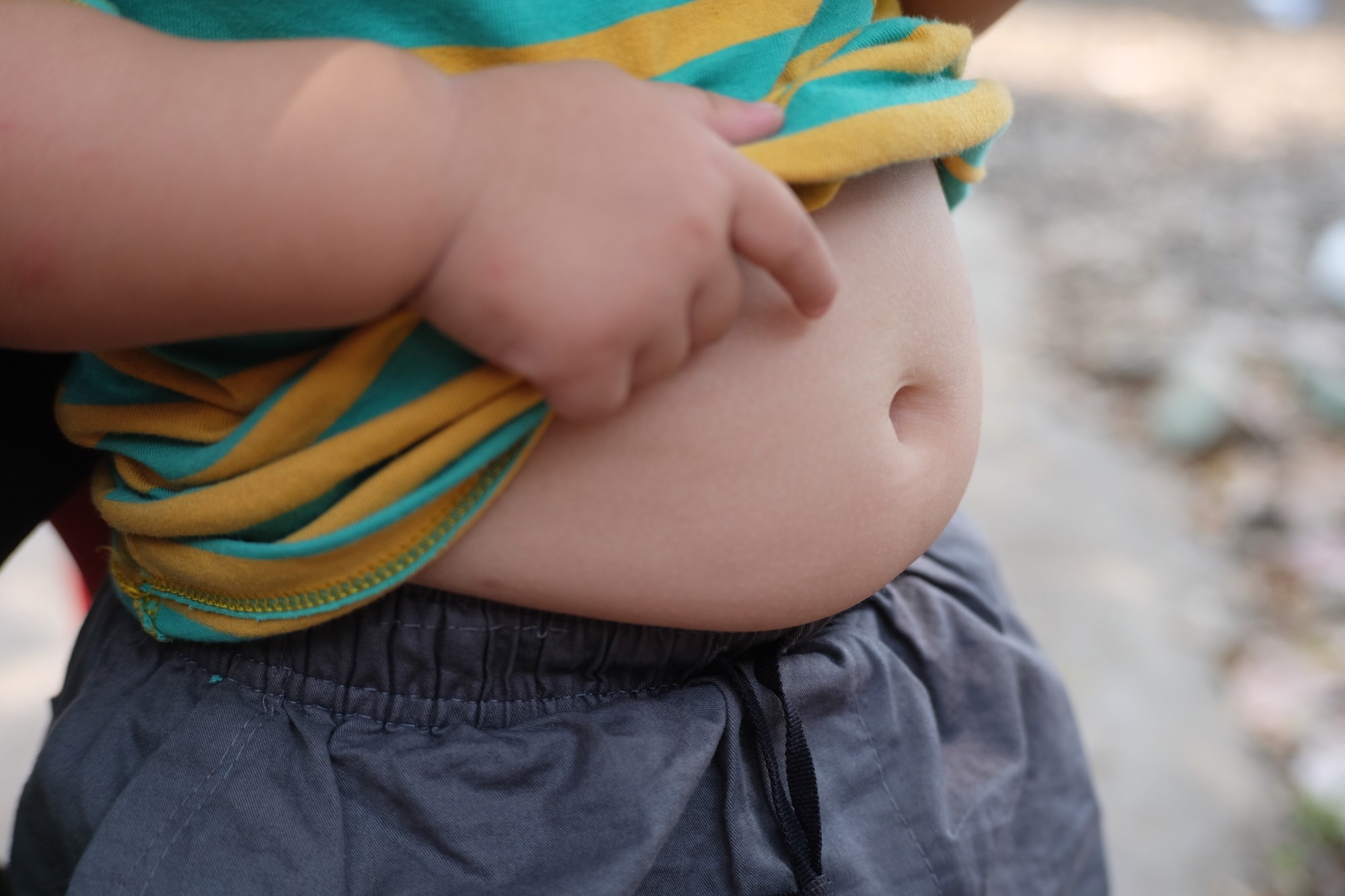 Study: Causal relationship between gut microbiota and childhood obesity: a Mendelian randomization study and case–control study. Image Credit: Leeferiin / Shutterstoc