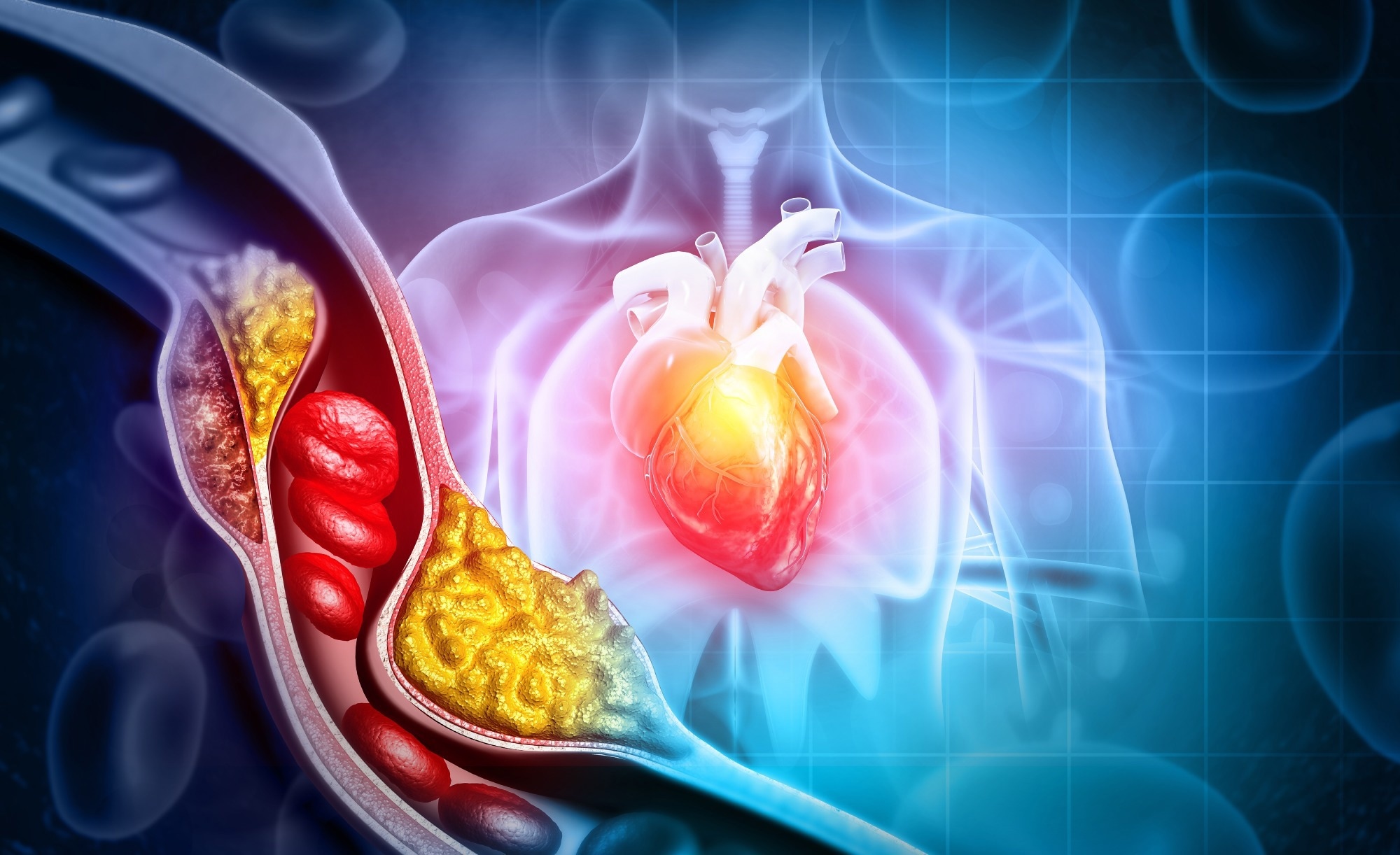 Study: Waist-to-height ratio and body fat percentage as risk factors for ischemic cardiovascular disease: a prospective cohort study from UK Biobank. Image Credit: crystal light / Shutterstock